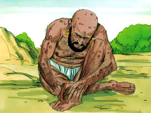 Satan struck Job with a disease and his whole body was covered with big sores that tormented Job